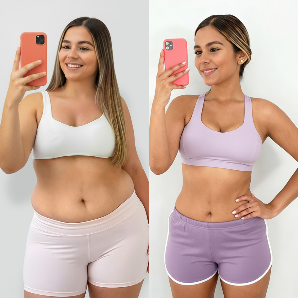 Resultados antes y después del cuerpo de una mujer al usar Vibro Sculpt para reducción de medidas