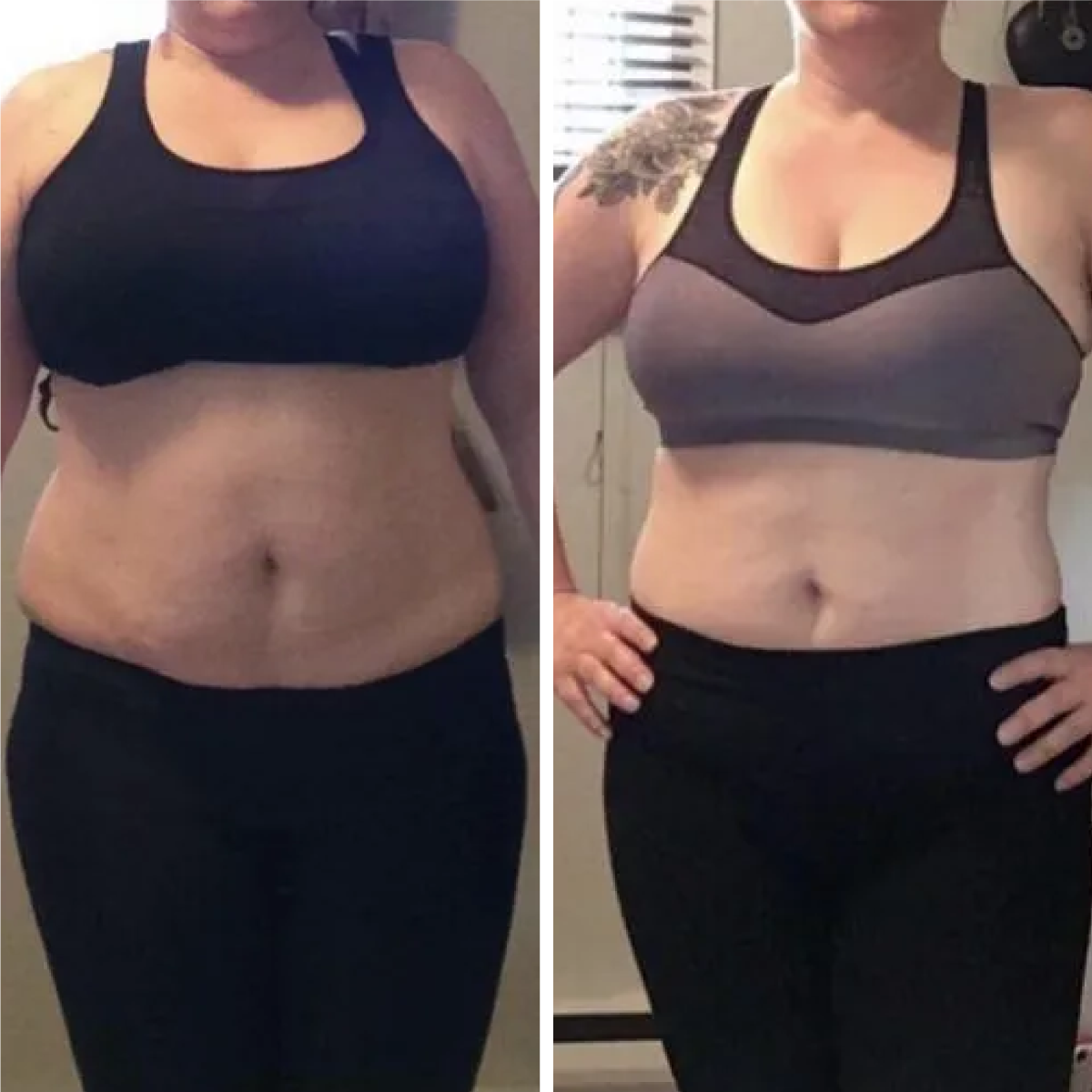 Comparación frontal antes y después de mujer con reducción en abdomen y cintura gracias a Vibro Sculpt